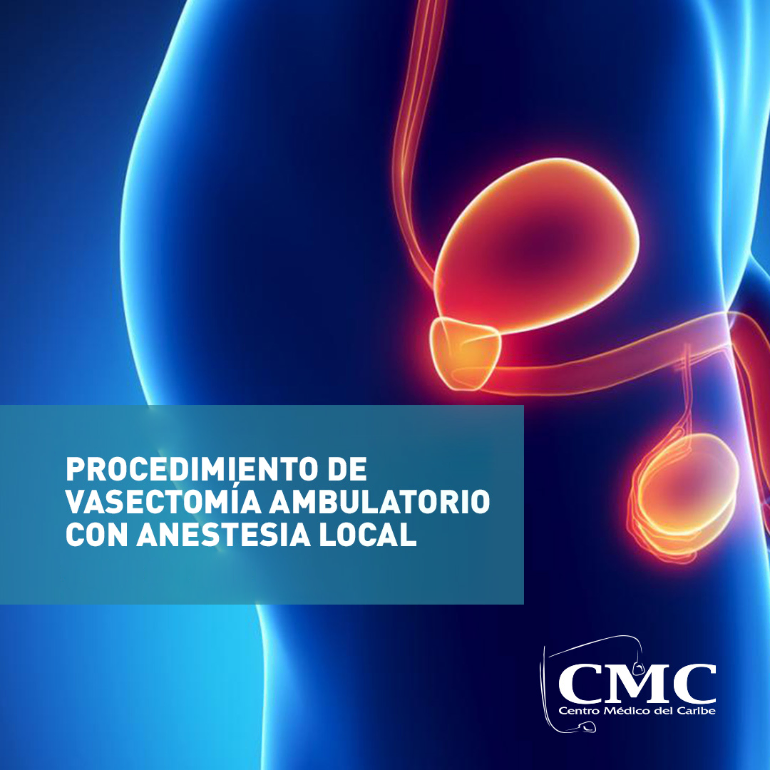 Procedimiento De Vasectomia Ambulatoria Cmc El Mejor Centro Medico En Colon